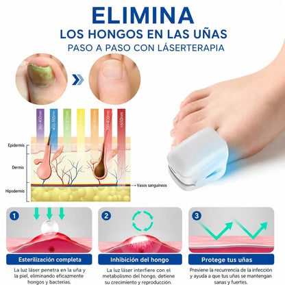 Nailux™ La luz que por fin llega bajo la uña — vuelve a enseñar los pies sin taparlos + Hoy incluye GRATIS aceite natural que acelera el proceso