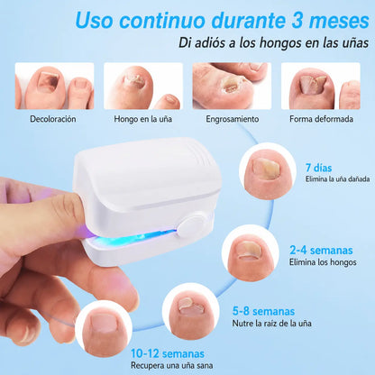 Nailux™ La luz que por fin llega bajo la uña — vuelve a enseñar los pies sin taparlos + Hoy incluye GRATIS aceite natural que acelera el proceso