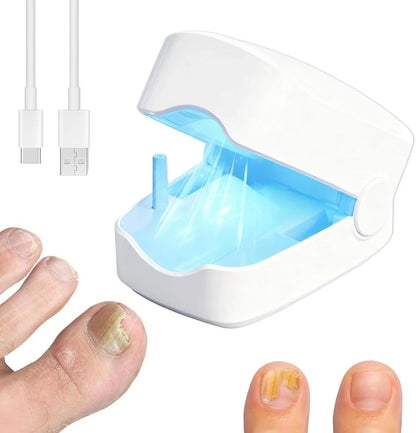 Nailux™ La luz que por fin llega bajo la uña — vuelve a enseñar los pies sin taparlos + Hoy incluye GRATIS aceite natural que acelera el proceso